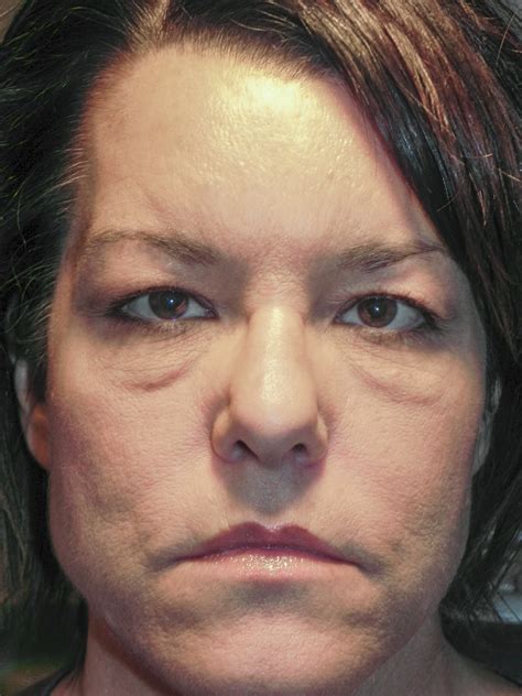festoons on face 6