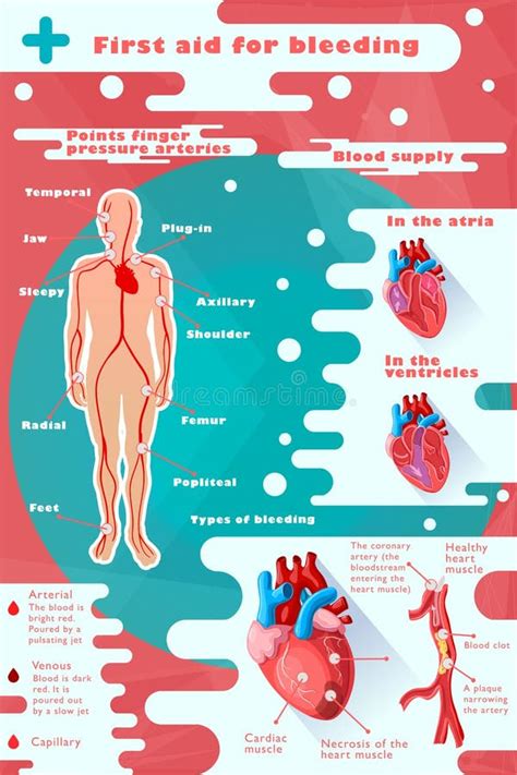 Arterial And Venous Bleeding Stock Vector - Illustration of bleeding ...