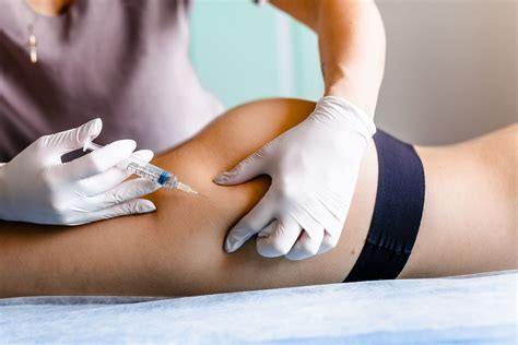 Lipoliză - Zaez Medical