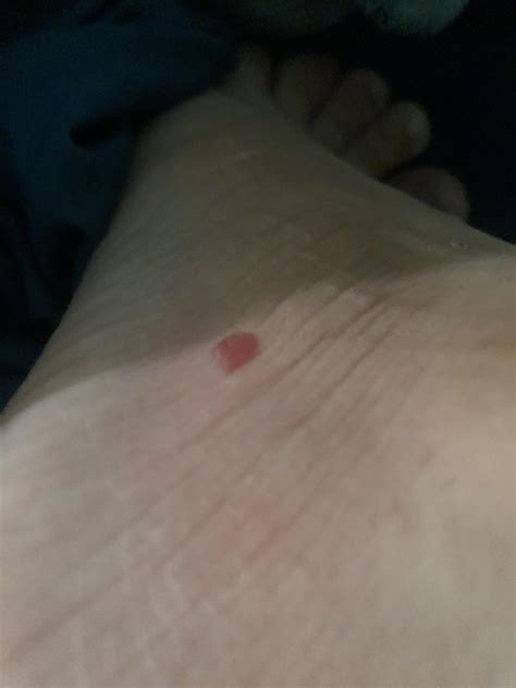 Woke up with this on my left foot, it doesn’t hurt or itch any idea