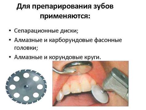 Препарирование зубов под искусственную коронку с уступом на