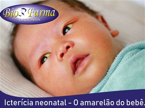 O Que Causa Amarelao No Recem Nascido