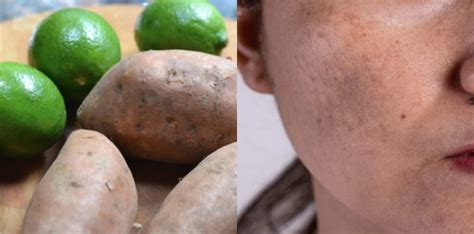 jeragat muka  hilang  tonyoh guna bahan dapur