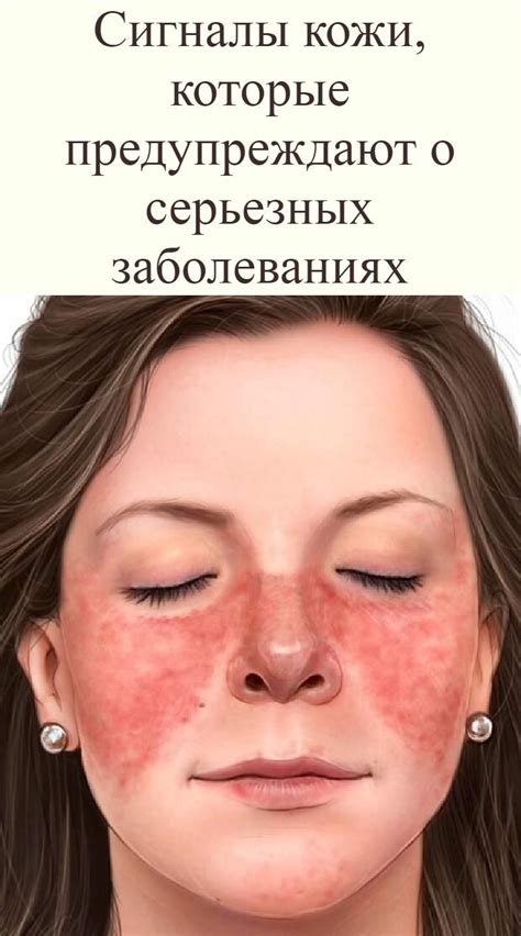 Сигналы кожи, которые предупреждают о серьезных заболеваниях