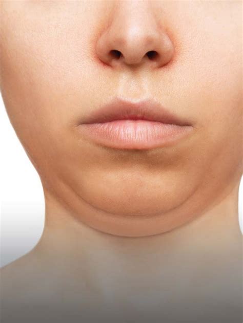6 exercises to avoid double chin