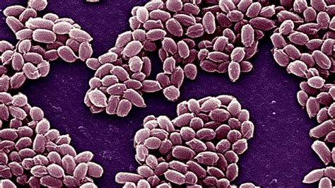 Сибирская язва– что это за болезнь, 💉 лечение, симптомы и 🔬 диагностика ...