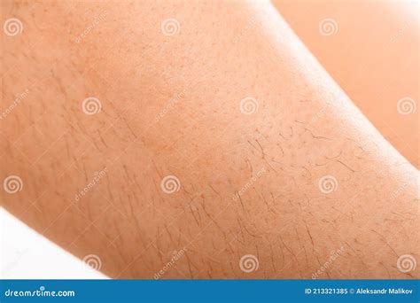 Epilated Area Stock Photos - Free & Royalty-Free Stock Photos from ...