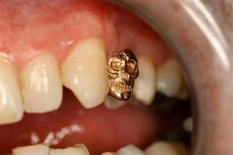 Pin by Amy Izquierdo on Odontología | Dental jewelry, Teeth jewelry ...