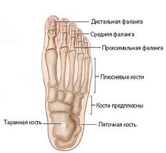 Плюсневая кость - перелом, смещение, строение