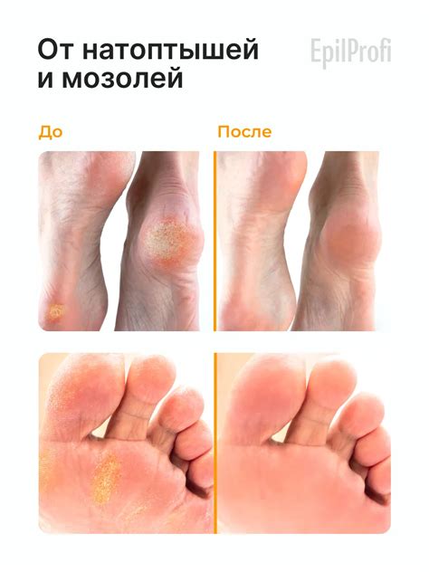 Крем воск от трещин для сухой кожи EpilProfi купить по цене 11,49 р. в ...