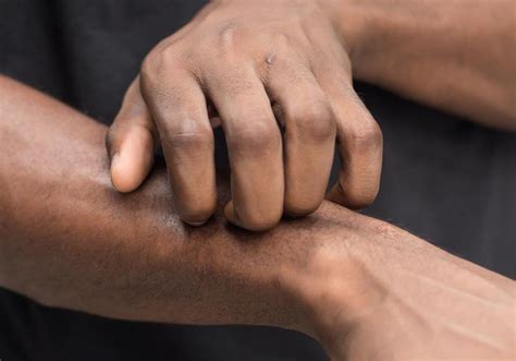 learn    soothe  itchy skin aveeno