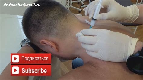 Лечение БОЛЬ В ШЕЕ | БЛОКАДА | Cervical Injections - YouTube