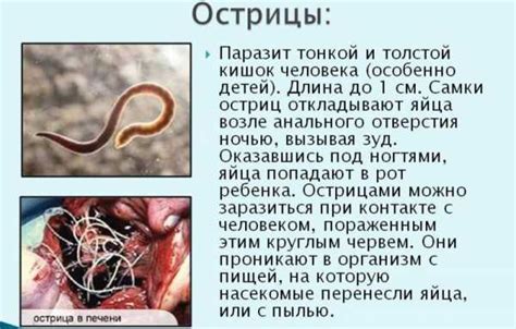 Свечи от остриц при беременности – Острицы при беременности - чем ...