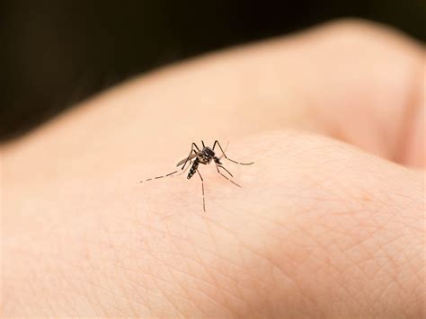 Mosquito Bite Allergy: Skeeter Syndrome Symptoms, Explained | SELF