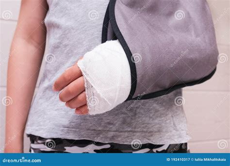 Hand Fracture Bandage