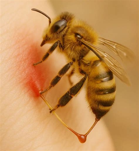 honey bee sting venom honey buzz