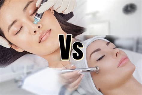 Hydrafacial or Microdermabrasion | Which treatment is best?