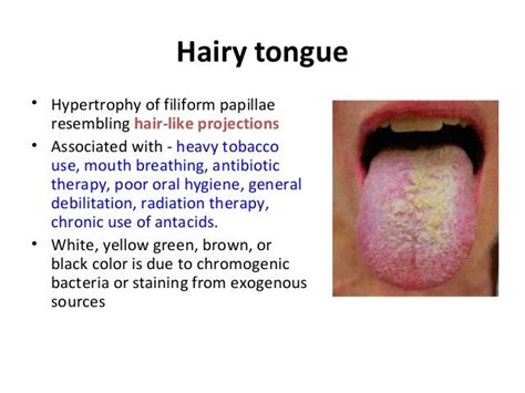 tongue lecture