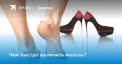Мозоль на ноге от обуви: как быстро вылечить в домашних условиях