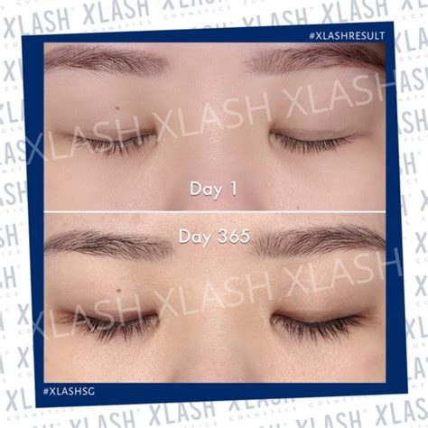 XLASH Eyelash Serum 3ml - NEW Packaging - Xlash Cosmetics Singapore