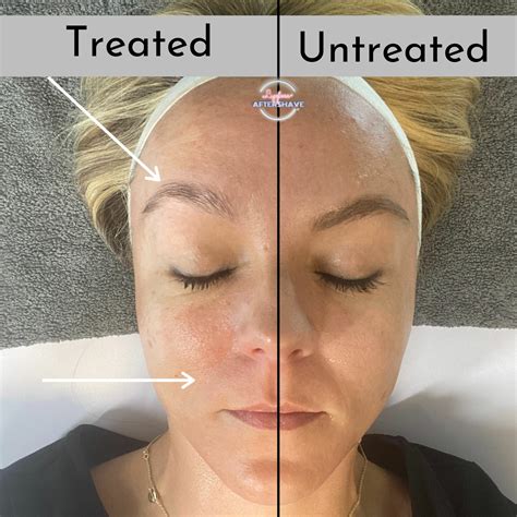 Sammy Ts: Before & After Results That Will Shock You! Image 2