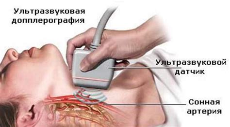 УЗИ щитовидной железы