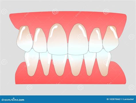 Dientes anteriores humanos stock de ilustración. Ilustración de copia ...