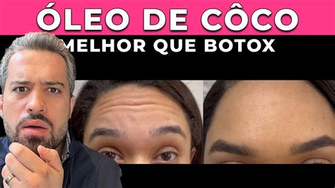 Como Usar Óleo De Coco No Rosto - ÓLEO DE CÔCO no ROSTO - RENOVA E ESTICA A PELE - YouTube