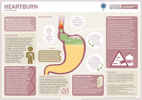 heartburn explained infographic  infographics