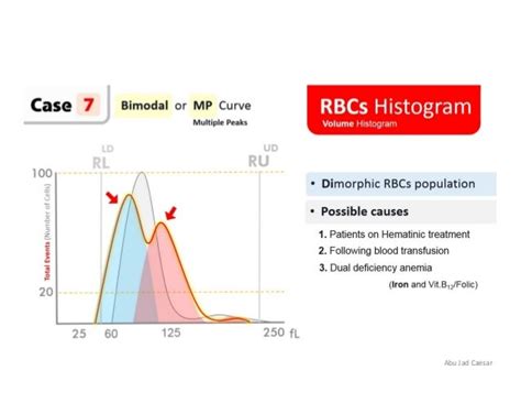 RBC Histogram