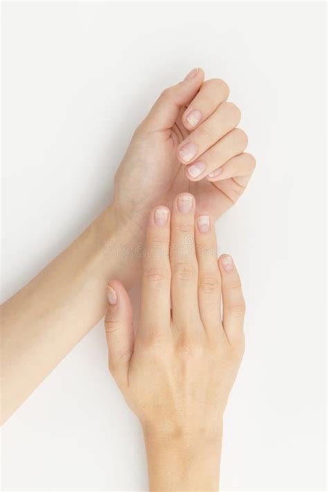 Fingernails with Onycholysis after Removing Gel Polish. Womans Hands ...