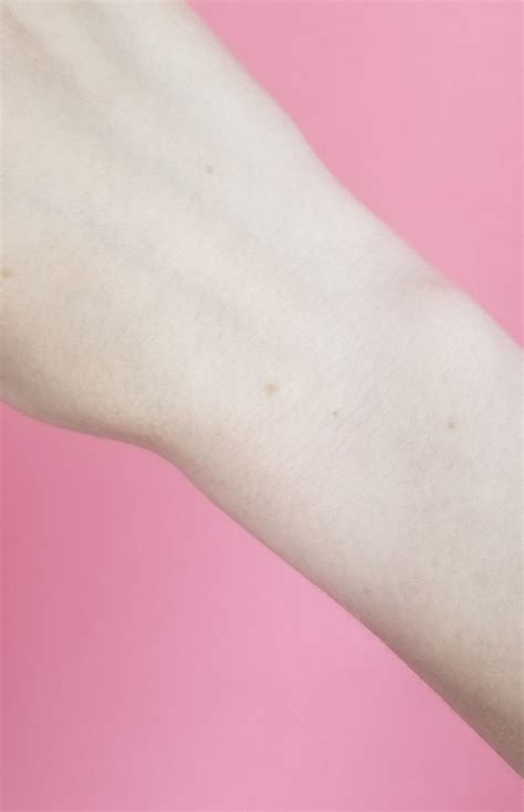 Viral 'Wrist Freckle Challenge' Has People Sharing Photos of Matching