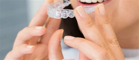 Are At-Home Aligners Safe? | Call Us | Definitive Dental