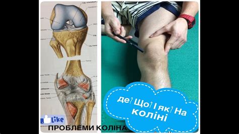 Коліно, проблеми коліна (Анатомічно орієнтаційні пункти на коліні ...