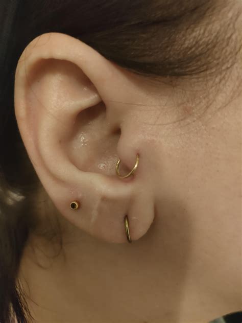 Learning why is there a bump on my earlobe surprised me 17