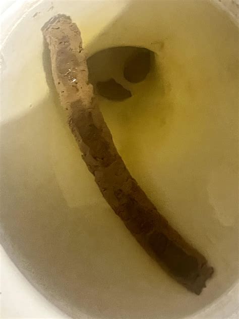 The Fascinating And Bizarre History Behind The Official Record For The Worlds Longest Turd Ever Documented 6