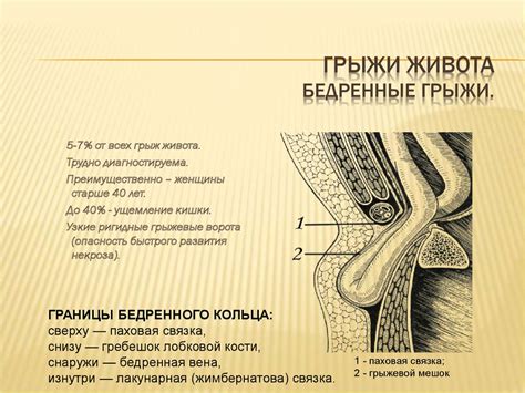 Грыжи живота - презентация онлайн