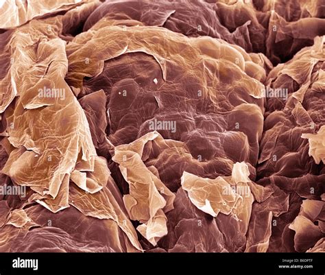 Human Skin Cell Under Electron Microscope Micropedia | Images and Photos finder