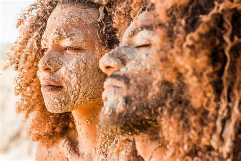 Dry And Peeling Skin Face Photos, Download The BEST Free Dry And