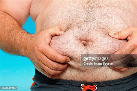 33 Excess Body Hair Stock Photos, High-Res Pictures, and Images - Getty ...