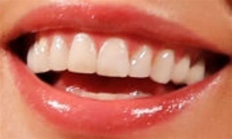 Kate Beckinsale Teeth Pictures