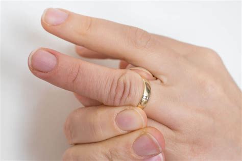 how to get off a ring from a swollen finger