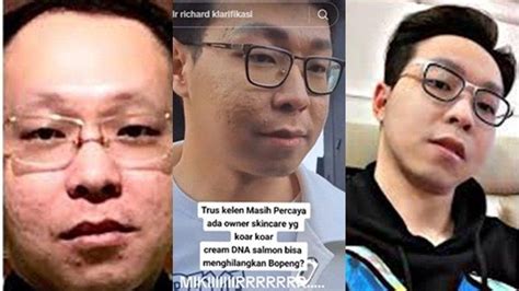 video dulu pamer foto aib sebelum kenal perawatan  wajah asli