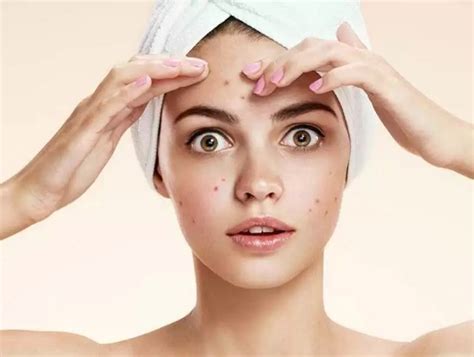 salicylic acid  effective cleanser  eliminate acne  scars