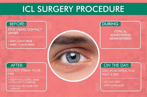 icl surgery preparation steps eligibility aftercare