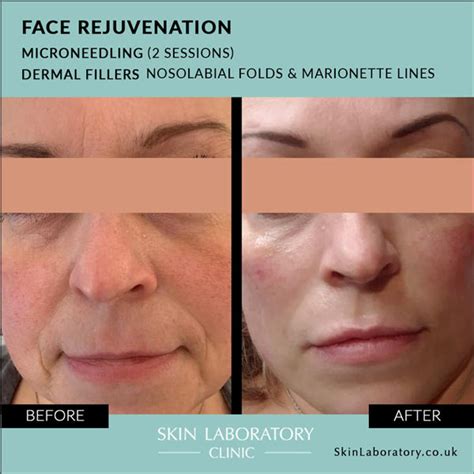 aesthetic treatments skin laboratory clinic