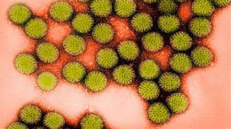 Rotavirus Still Ranks High as Cause of Acute Gastroenteritis in ...