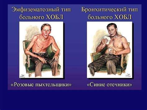 Хроническая обструктивная болезнь легких (ХОБЛ) - презентация онлайн