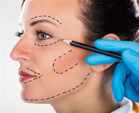 Face Lift | Reviveskin Medical Spa