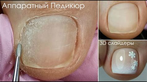 Новогодний Педикюр/Мой педикюрный Пылесос! - YouTube